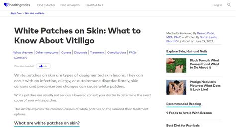 White Dry Patches On Skin Beauty Tips