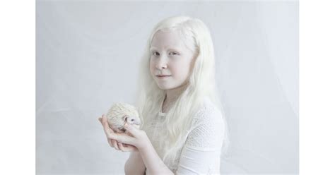 Yulia Taits S Porcelain Beauty Series Albinism Photographs Yulia The Best Porn Website