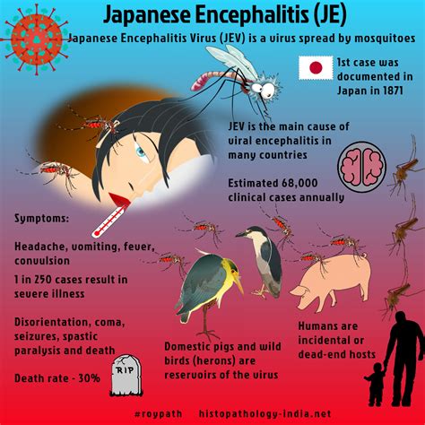 Pathology Of Japanese Encephalitis Roypath Japanese Encephalitis Medical Posters Japanese