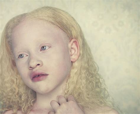Albinos Um Belo Trabalho De Fotografia MDig