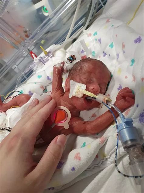 My Baby Was Born 15 Weeks Early In The Middle Of A Pandemic Wales Online