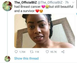 Breast Cancer Survivor Shares Topless Photo After Undergoing Double