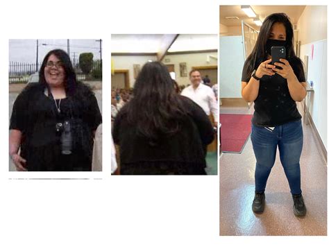 F3354” 48919982892lbs Ive Been Morbidly Obese My Whole Life
