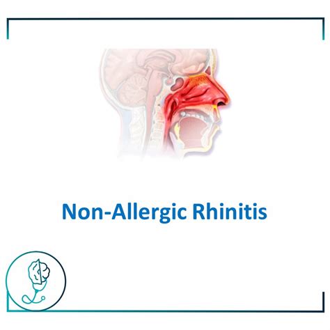 Non Allergic Rhinitis The Childrens Allergy Private Paediatric
