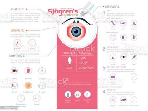 World Sjögrens Syndrome Day Infographic Of Eyes With Artificial Tears