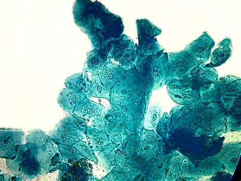 To study the microscopic to study the microscopic structures of human cheek cells under a compound microscope. The use of Brillant Blue #1 as a nuclear dye useful for ...