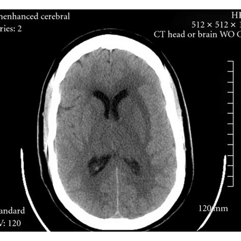 Ct scans can produce detailed images of many structures inside the body, including the internal organs, blood vessels and bones. 24 Hour Ct Scan Near Me - ct scan machine