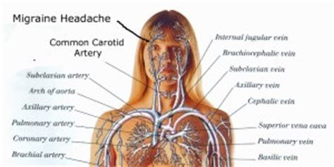 Origin the right common carotid artery originates behind the sternoclavicular. THE PAIN IN MY BRAIN | bipolarbarebook.com
