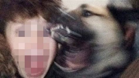 Menino Leva 21 Pontos No Rosto Ao Ser Mordido Por Cão Enquanto Tirava