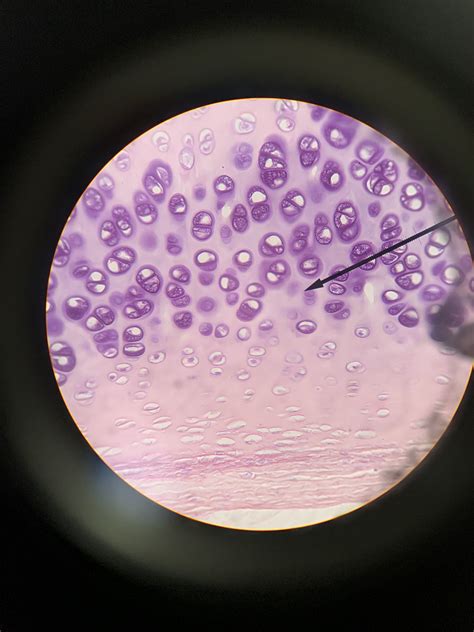 Hyaline Cartilage Microscope Image