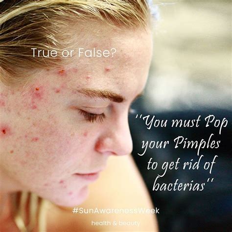 True Or False False Popping Your Pimples Worsens Blemishes Spreads