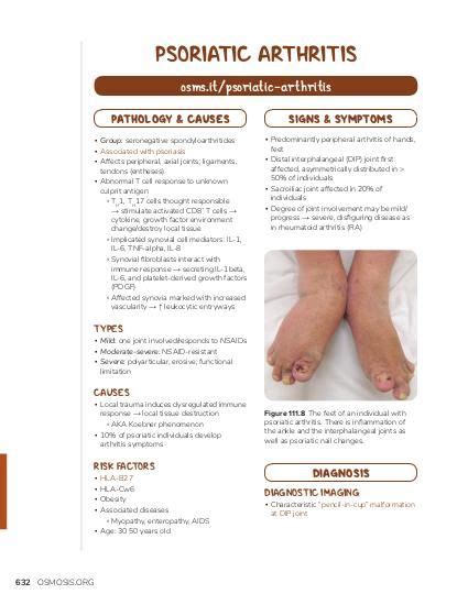 Psoriatic Arthritis Osmosis