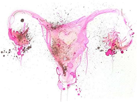 Endometriosis Signs Of Endometriosis