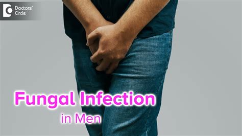 Fungal Infection In Men Causes Treatment Yeast Infection In Men