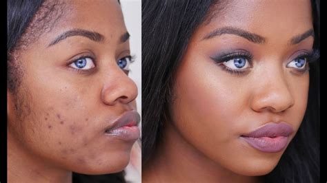 video how to cover acne scars on dark skin