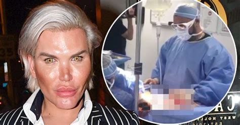 Watch The Moment Human Ken Doll Has Four Ribs Removed Ok Magazine