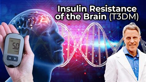 Understanding Insulin Resistance Of The Brain A Comprehensive Guide