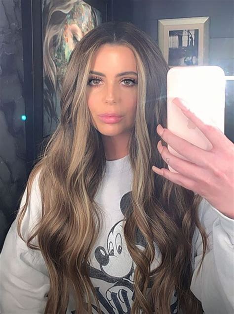 Brielle Biermann Feels Completely Different After Lip Fillers Removal