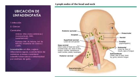 Linfadenopatia Y Esplenomegalia
