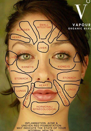 Breakouts here may mean that an individual may need to hydrate and clean up their diet by drinking purified or. #Face chart , Zits #pimples ... why they show up where ...