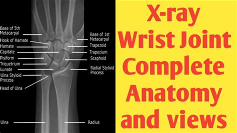 X Ray Wrist Joint Complete Anatomy And Views Youtube