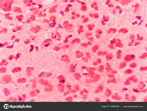 Gram Negative Diplococci Intracellular Stock Photo By ©toeytoey 150602382