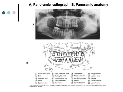 Ppt Panoramic Radiography Powerpoint Presentation Free Download Id
