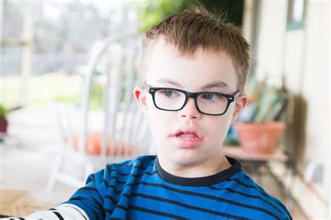 Boy With Downs Syndrome Flexing His Muscles Stock Photo By ©gregorydean