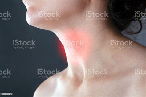 Sore Throat Allergy Flu Cold Angina Inflamed Lymph Nodes Stock Photo
