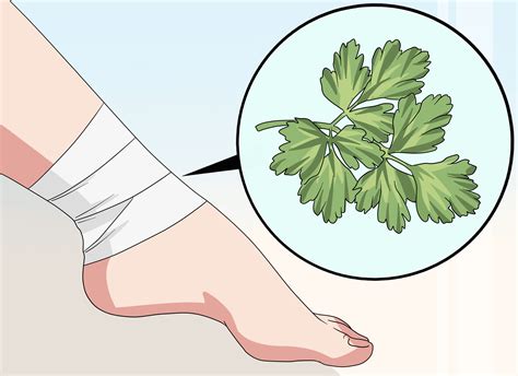 How To Heal A Bruise 9 Steps With Pictures Wikihow