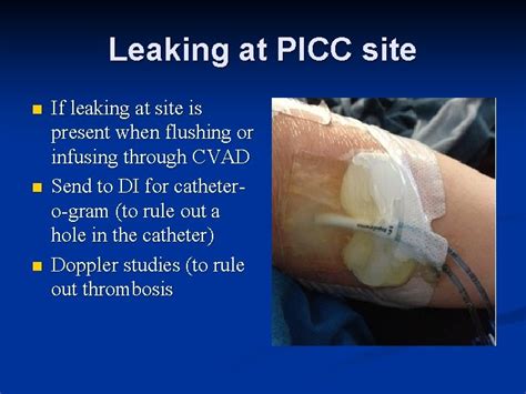 What Is The Difference Between A Picc Line And A Peripheral Iv Ivwatch