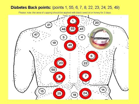 Cupping Therapy Points Chart