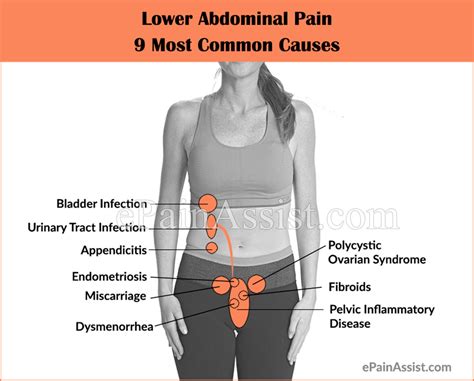 Lower Abdominal Pain Most Common Causes Symptoms Investigations Treatment
