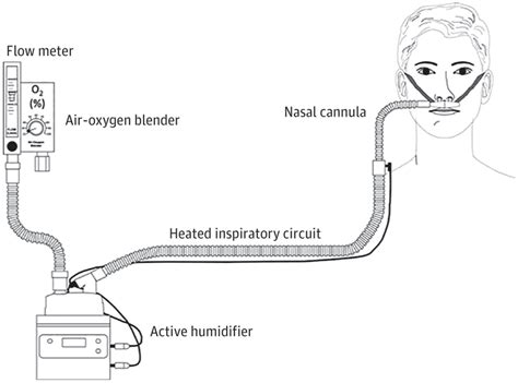 • nebuliser spacers or a t piece can be used in conjunction with hhnc. High-Flow Nasal Cannula System: Not Just Another Nasal ...