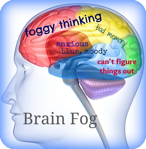 Brain Fog Causes Symptoms And How To Get Rid Of Brain Fog