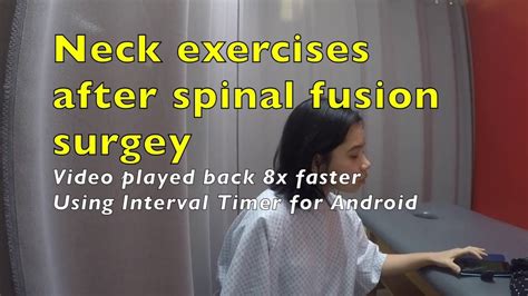 Neck Exercises After Spinal Fusion Surgery And Neck Bracing Youtube