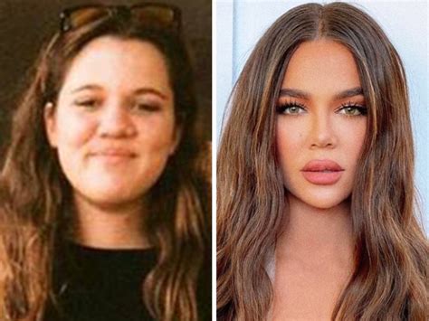 Shocking celebrity faces before and after: Khloe Kardashian, Kim 