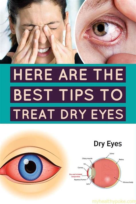 What To Do When You Have Dry Eyes Here Are The Must Apply Tips To