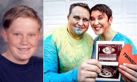 Man Who Didn T Hit Puberty Until He Was Due To Rare Genetic Disorder Daily Mail Online