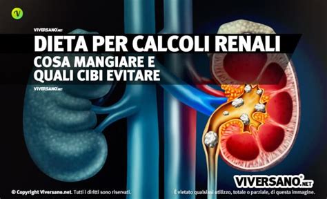 Se si soffre di calcoli renali, seguire una dieta corretta è un passo fondamentale per evitare che questi raggiungano dimensioni importanti e diventino quindi ancora più e dolorosi. Dieta per calcoli renali: cosa mangiare, cosa evitare e 5 ...