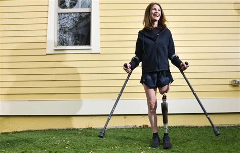Osseointegration Surgery Gives Amputee Hope For Better And Stronger Life