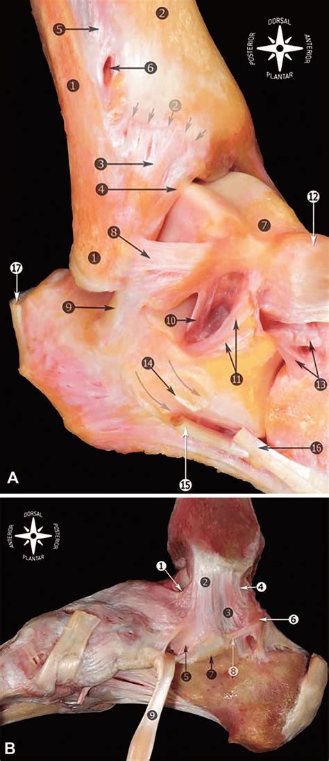 Diagrams are easier and faster to understand than text, so they are more appropriate to document systems than comments in millions of lines of code, although these are also important! Anatomy of the ankle ligaments. Right ankle. A, Fibula and ...