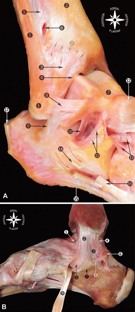 It connects bone and muscles. Anatomy of the ankle ligaments. Right ankle. A, Fibula and ...