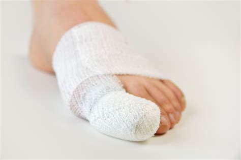 Broken Toe Vs Sprained Toe Whats The Difference Triad Foot And Ankle