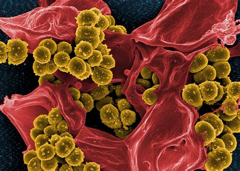15121 Staphylococcus Aureus Biology Libretexts