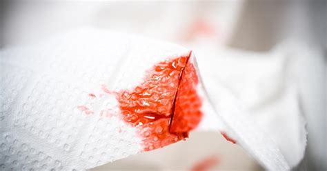 Implantation Bleeding Or Period