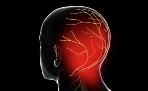 Occipital Nerve Radiofrequency Ablation Briz Brain And Spine
