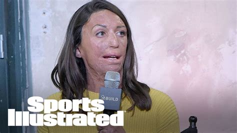 How Turia Pitt Overcame Brush Fire Burns To Become Ironman Finisher SI NOW Sports
