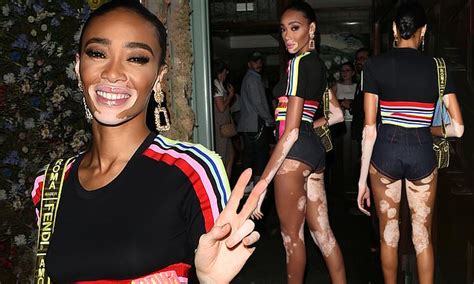 Winnie Harlow Flaunts Her Pins In Tiny Hot Pants As She Kicks Off Her