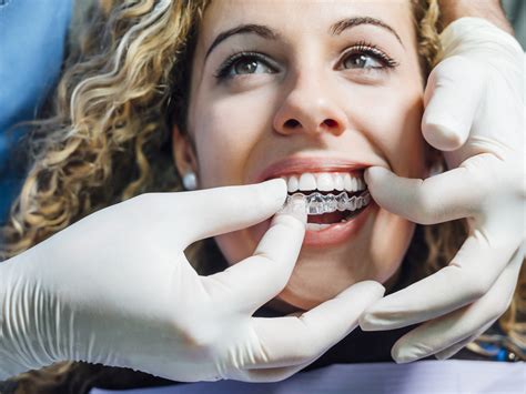 Is It Ok To Get Invisalign From A General Dentist